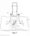 Fig. 08 - Tissue retractor