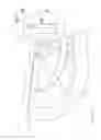 Fig. 07 - Hook attachment for mobile stand for use with intravenous delivery of medications