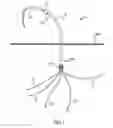 Fig. 02 - Multi-catheter infusion system and method thereof