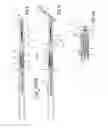 Fig. 09 - Intravenous catheter insertion and blood sample devices and method of use