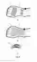 Fig. 06 - Devices, Systems and Methods for Treating Urological and Gastrointestinal Disorders by Electrical Stimulation of the Foot