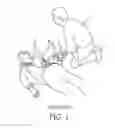 Fig. 02 - Defibrillator with scheduled and continuous modes of operation