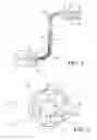Fig. 02 - IMPLANTABLE DEVICE FOR OPTICALLY STIMULATING THE BRAIN COMPRISING A MULTI-CHANNEL CATHETER