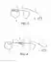 Fig. 03 - IMPLANTABLE DEVICE FOR OPTICALLY STIMULATING THE BRAIN COMPRISING A MULTI-CHANNEL CATHETER