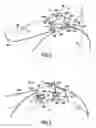 Fig. 03 - Clamping collar with a transverse buckle