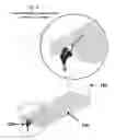 Fig. 05 - Total Drain Container Device System