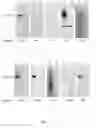 Fig. 02 - TEM-1 diagnostic antibodies