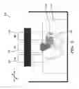 Fig. 06 - Method and system for oblique backscattering ultrasound transmissive contrast imaging