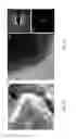Fig. 04 - Amorphous, porous silicon materials and related methods