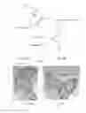 Fig. 01 - Wireless mechanism for detecting an open or closed container, and methods of making and using the same
