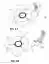 Fig. 02 - ONE-DIRECTIONAL PISTON-TUBE ELECTROSTATIC MICROACTUATOR