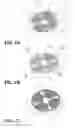 Fig. 05 - ONE-DIRECTIONAL PISTON-TUBE ELECTROSTATIC MICROACTUATOR