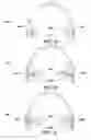 Fig. 03 - Facilitation of headphone audio enhancement