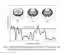 Fig. 05 - Ultrawideband Co-polarized Simultaneous Transmit and Receive Aperture (STAR)