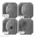 Fig. 03 - PROJECTION IN ENDOSCOPIC MEDICAL IMAGING