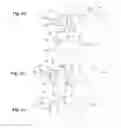 Fig. 02 - Detachable filter member for hearing aid device
