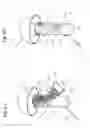 Fig. 05 - Detachable filter member for hearing aid device