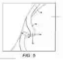 Fig. 05 - Turf treatment