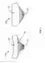 Fig. 02 - Pull Away Undergarment