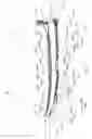 Fig. 02 - Sole Structure with Adjustable Flexibility