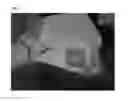 Fig. 08 - Method of Detecting Potential Deep Tissue Injury