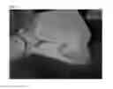 Fig. 09 - Method of Detecting Potential Deep Tissue Injury