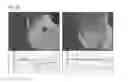 Fig. 15 - Method of Detecting Potential Deep Tissue Injury