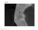 Fig. 25 - Method of Detecting Potential Deep Tissue Injury