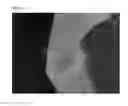 Fig. 26 - Method of Detecting Potential Deep Tissue Injury