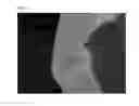 Fig. 27 - Method of Detecting Potential Deep Tissue Injury