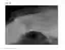 Fig. 28 - Method of Detecting Potential Deep Tissue Injury
