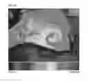 Fig. 41 - Method of Detecting Potential Deep Tissue Injury