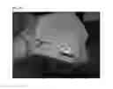 Fig. 45 - Method of Detecting Potential Deep Tissue Injury