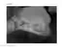 Fig. 50 - Method of Detecting Potential Deep Tissue Injury