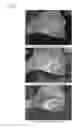 Fig. 60 - Method of Detecting Potential Deep Tissue Injury