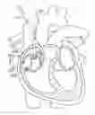Fig. 01 - Catheter systems and related methods for mapping, minimizing, and treating cardiac fibrillation