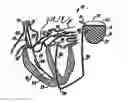 Fig. 01 - Electrocardiogram reconstruction from implanted device electrograms
