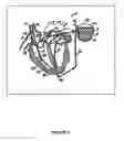 Fig. 02 - Electrocardiogram reconstruction from implanted device electrograms
