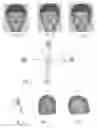 Fig. 02 - Method for the automated and assisted acquisition of anatomical surfaces