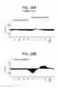 Fig. 45 - Methods and kits for diagnosing, assessing or quantitating drug use, drug abuse and narcosis, internuclear ophthalmoplegia, attention deficit hyperactivity disorder (ADHD), chronic traumatic encephalopathy, schizophrenia spectrum disorders and alcohol consumption