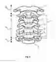 Fig. 03 - Vertebral feature identification