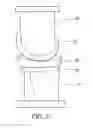Fig. 04 - System and method of measuring in vivo wear in artificial knee joint