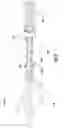 Fig. 04 - Endotracheal tubes and systems and methods for evaluating breathing