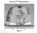 Fig. 14 - Anatomical imaging system with centipede scanning drive, bottom notch to accommodate base of patient support, and motorized drive for transporting the system between scanning locations