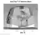 Fig. 16 - Anatomical imaging system with centipede scanning drive, bottom notch to accommodate base of patient support, and motorized drive for transporting the system between scanning locations