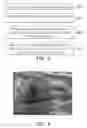 Fig. 03 - ANALYSIS METHOD FOR BREAST IMAGE AND ELECTRONIC APPARATUS USING THE SAME