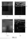 Fig. 04 - ANALYSIS METHOD FOR BREAST IMAGE AND ELECTRONIC APPARATUS USING THE SAME