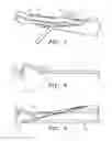 Fig. 08 - Suture apparatus, system and method
