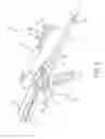 Fig. 03 - Tissue ingrowth materials and method of using the same