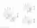 Fig. 11 - Tissue ingrowth materials and method of using the same